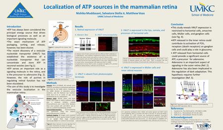 Localization of ATP sources in the mammalian retina Nishika Muddasani, Salvatore Stella Jr, Matthew Voas UMKC School of Medicine Introduction ATP has always.