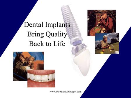Www.rxdentistry.blogspot.com Dental Implants Bring Quality Back to Life.