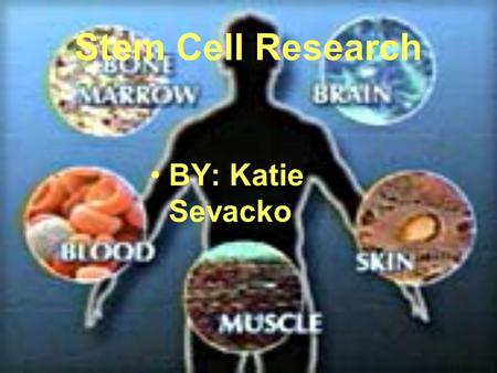 Stem Cell Research BY: Katie Sevacko.
