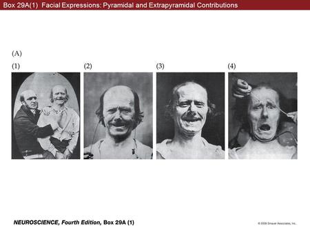 Box 29A(1) Facial Expressions: Pyramidal and Extrapyramidal Contributions.