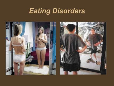 Eating Disorders. Lesson Goals Intro- Big Picture of Eating Disorders - Link to mental health/ Teens Tap into our prior knowledge -Part 1- Eating Disorder.