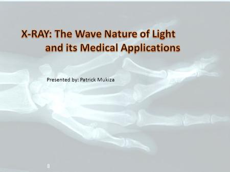 Z Presented by: Patrick Mukiza. OVERVIEW o Introduction o X-Rays: Wave Nature of light o Medical Applications o Socio-Economic Benefits of X-Rays o Adverse.