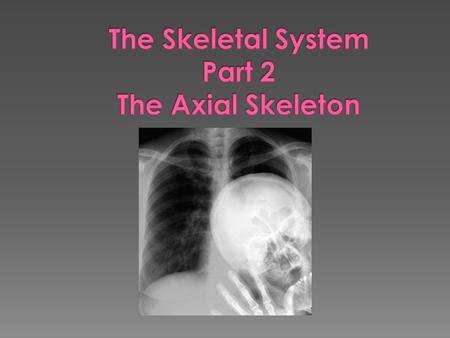  Forms the longitudinal part of the body  Divided into three parts › Skull › Vertebral column › Bony thorax.