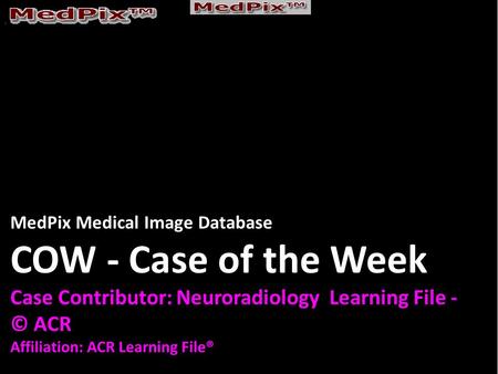 MedPix Medical Image Database COW - Case of the Week Case Contributor: Neuroradiology Learning File - © ACR Affiliation: ACR Learning File®