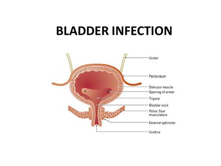 prostatitis a férfiakban amelyek)