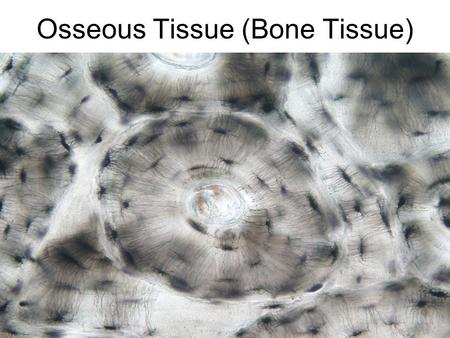 Osseous Tissue (Bone Tissue). Classification of Bone by Tissue Type Two basic types of Tissue 1. Compact bone Homogeneous Looks “smooth” 2. Spongy bone.