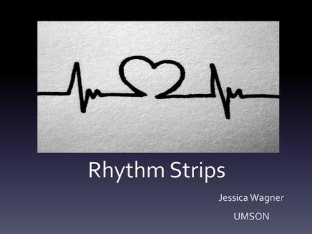 Rhythm Strips Jessica Wagner UMSON. EKG Grid.