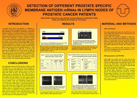 DETECTION OF DIFFERENT PROSTATE SPECIFIC MEMBRANE ANTIGEN mRNAs IN LYMPH NODES OF PROSTATE CANCER PATIENTS Ulrike Fiedler, Romy Kranz, Jana Scholze, Andreas.