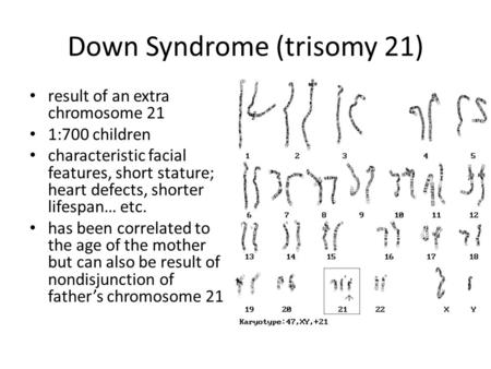 Down Syndrome (trisomy 21)