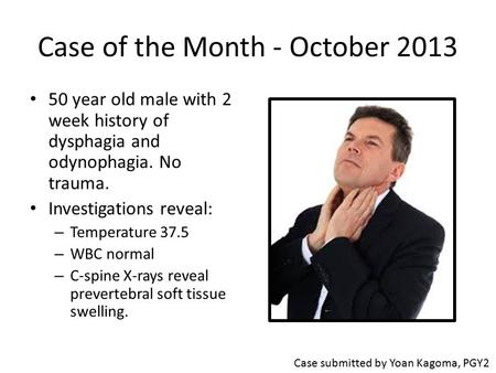 Case of the Month - October 2013 50 year old male with 2 week history of dysphagia and odynophagia. No trauma. Investigations reveal: – Temperature 37.5.