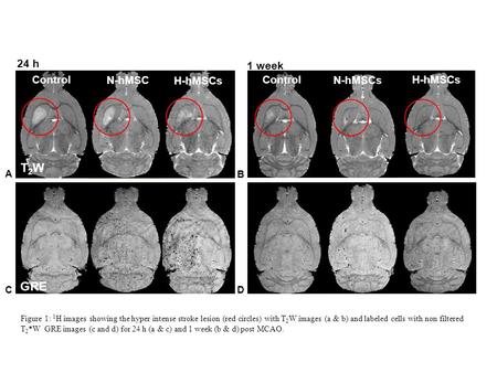 H-hMSCs GRE T2WT2W Control N-hMSC H-hMSCsControl N-hMSCs 24 h 1 week A B CD Figure 1: 1 H images showing the hyper intense stroke lesion (red circles)