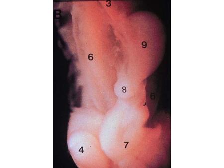 DIGESTIVE SYSTEM 01 51/2 WEEK EMBRYO: Identify the ESOPHAGUS (3), STOMACH (9), HEPATIC DIVERTICULUM (8), MIDGUT (7), and MESONEPHROS (6) on this dissected.