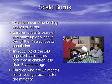 Scald Burns Scald burns are the leading causes of burns. Scald burns are the leading causes of burns. Children under 5 years of age make up only about.