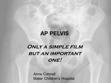 Anne Connell Mater Children’s Hospital AP PELVIS Only a simple film but an important one! Anne Connell Mater Children’s Hospital.