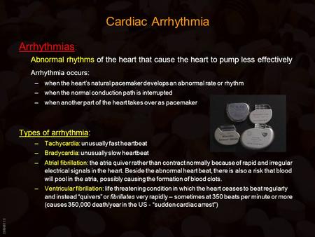 BIMM118 Cardiac Arrhythmia Arrhythmias : Abnormal rhythms of the heart that cause the heart to pump less effectively Arrhythmia occurs: –when the heart’s.