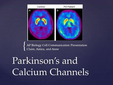 Parkinson’s and Calcium Channels