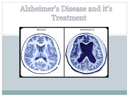  Alzheimer's disease (AD), also known as Senile Dementia of the Alzheimer Type (SDAT) or simply Alzheimer’s is the most common form of dementia. This.