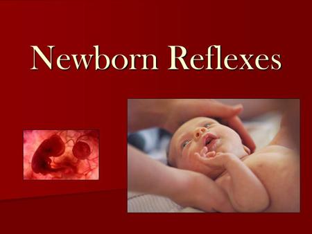 Newborn Reflexes.