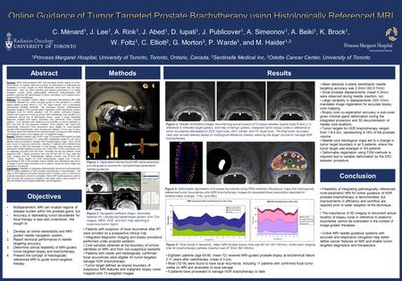 Online Guidance of Tumor Targeted Prostate Brachytherapy using Histologically Referenced MRI C. Ménard 1, J. Lee 1, A. Rink 1, J. Abed 1, D. Iupati 1,