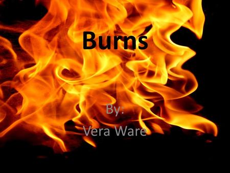 Burns By: Vera Ware.