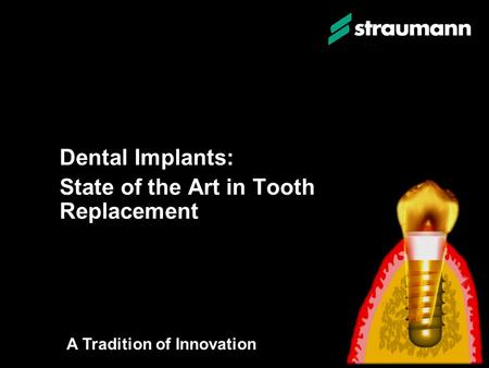 Dental Implants: State of the Art in Tooth Replacement Dental Implants: State of the Art in Tooth Replacement A Tradition of Innovation.