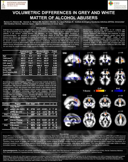 VOLUMETRIC DIFFERENCES IN GREY AND WHITE MATTER OF ALCOHOL ABUSERS Introduction Addiction has a multifactorial origin. Genetic load may predispose towards.