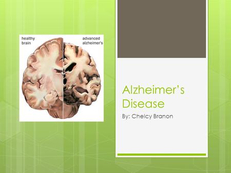 Alzheimer’s Disease By: Chelcy Branon. Facts  In 2006, there were 26.6 million sufferers worldwide  Costs 100 billion dollars per year.
