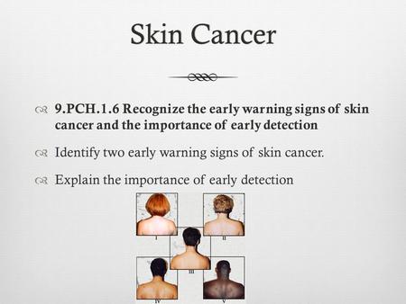 Skin CancerSkin Cancer  9.PCH.1.6 Recognize the early warning signs of skin cancer and the importance of early detection  Identify two early warning.