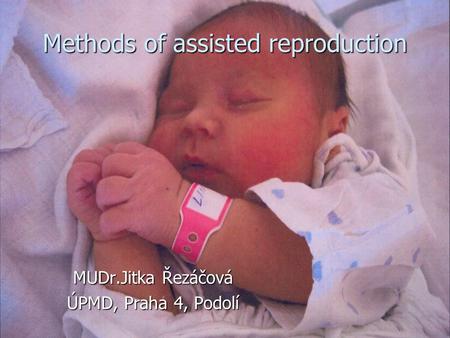 Methods of assisted reproduction MUDr.Jitka Řezáčová ÚPMD, Praha 4, Podolí.