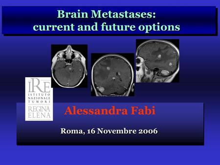 Alessandra Fabi Brain Metastases: current and future options Brain Metastases: current and future options Roma, 16 Novembre 2006.