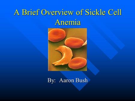 A Brief Overview of Sickle Cell Anemia By: Aaron Bush.