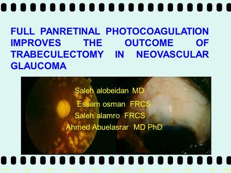 >>0 >>1 >> 2 >> 3 >> 4 >> FULL PANRETINAL PHOTOCOAGULATION IMPROVES THE OUTCOME OF TRABECULECTOMY IN NEOVASCULAR GLAUCOMA Saleh alobeidan MD Essam osman.