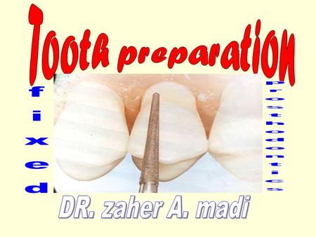 Tooth preparation fixed prosthodontics DR. zaher A. madi.
