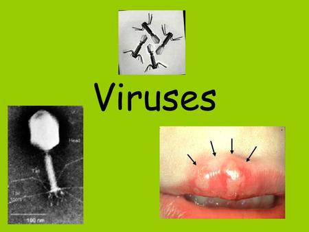 Viruses. What are Viruses? Virus – particles of nucleic acid, protein, and in some cases lipids –Not alive –Do NOT exhibit characteristics of life –Can.