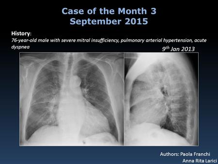 History : 76-year-old male with severe mitral insufficiency, pulmonary arterial hypertension, acute dyspnea Case of the Month 3 September 2015 Authors: