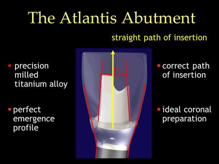 The Atlantis Abutment  precision milled titanium alloy  ideal coronal preparation  correct path of insertion  perfect emergence profile straight path.