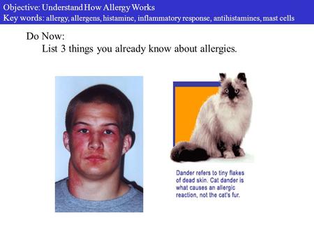 Do Now: List 3 things you already know about allergies. Objective: Understand How Allergy Works Key words: allergy, allergens, histamine, inflammatory.