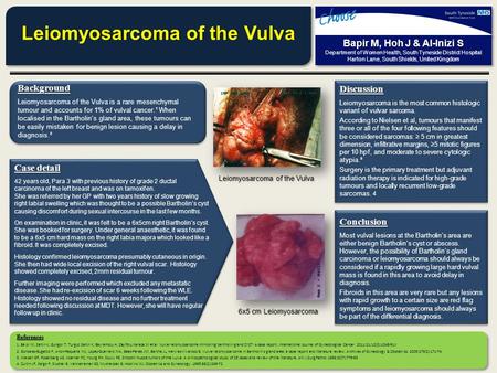 Leiomyosarcoma of the Vulva Bapir M, Hoh J & Al-Inizi S