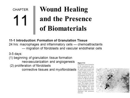 CHAPTER11 Wound Healing and the Presence of Biomaterials 11-1 Introduction: Formation of Granulation Tissue 24 hrs: macrophages and inflammatory cells.