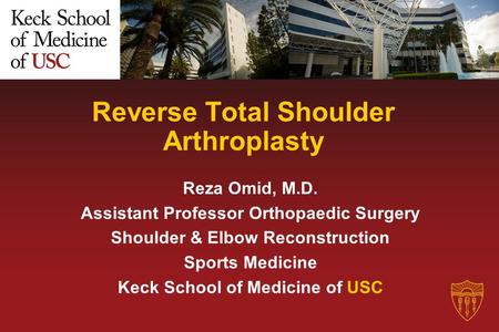 Reverse Total Shoulder Arthroplasty Reza Omid, M.D. Assistant Professor Orthopaedic Surgery Shoulder & Elbow Reconstruction Sports Medicine Keck School.