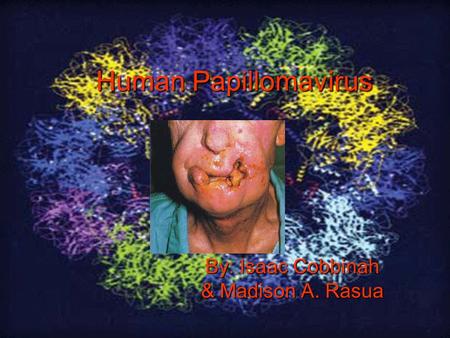 Human Papillomavirus By: Isaac Cobbinah & Madison A. Rasua.