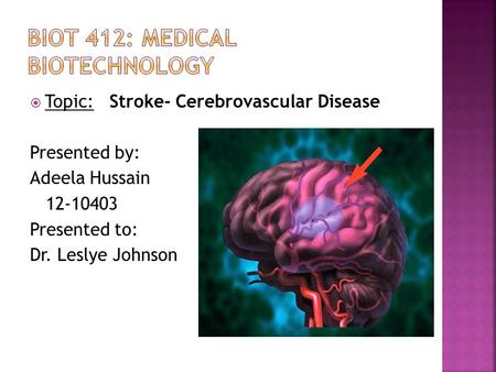  Topic: Stroke- Cerebrovascular Disease Presented by: Adeela Hussain 12-10403 Presented to: Dr. Leslye Johnson.