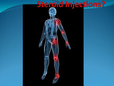 Who is a steroid injection for? Steroid injections are determined by the doctor based on the needs of each patient. If you have any questions about steroid.