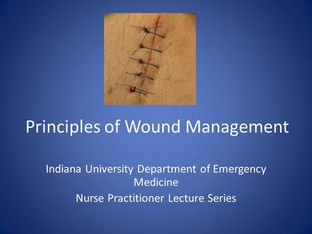 Principles of Wound Management Indiana University Department of Emergency Medicine Nurse Practitioner Lecture Series.