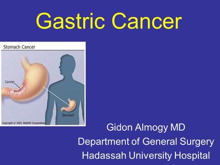 Gastric Cancer Gidon Almogy MD Department of General Surgery Hadassah University Hospital.