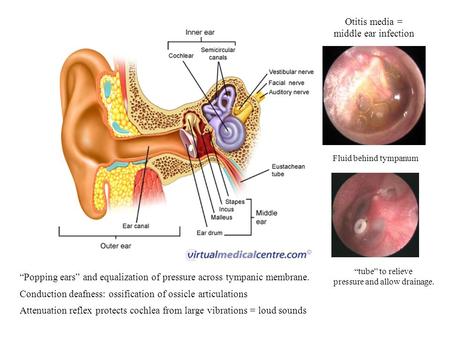 Conduction deafness: ossification of ossicle articulations Attenuation reflex protects cochlea from large vibrations = loud sounds Fluid behind tympanum.
