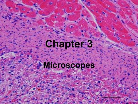 Chapter 3 Microscopes.