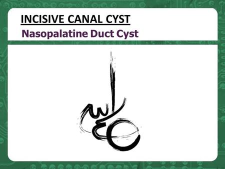 Nasopalatine Duct Cyst INCISIVE CANAL CYST. the most common nonodontogenic cyst of the oral cavity (in about 1% of the population). arise from remnants.