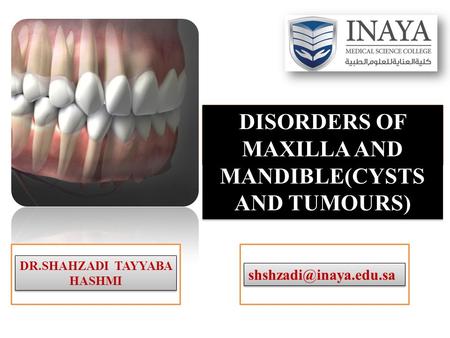 DISORDERS OF MAXILLA AND MANDIBLE(CYSTS AND TUMOURS) DR.SHAHZADI TAYYABA HASHMI