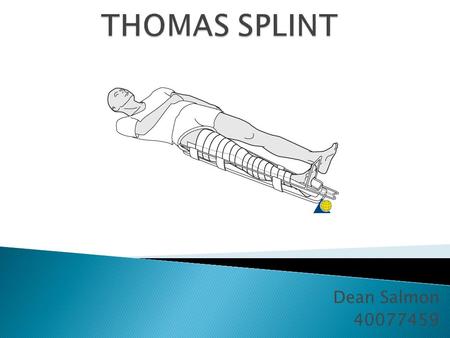 Dean Salmon 40077459.  Mid-shaft fractures of the Femur  Used in the emergency department to support the fracture and allow for easier mobilisation.